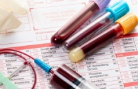 Анализ крови на гомоцистеин