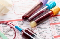 Анализ крови на гомоцистеин