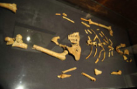 От родовых травм страдали и древние люди, утверждают археологи