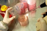 Стволовые клетки перевернут трансплантологию, заявляют эксперты
