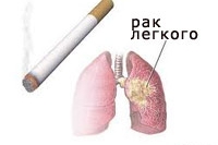 Рак легких становится женским Рак легких становится женским