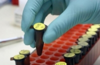 Минздрав запретит использовать биотехнологии для клонирования человека