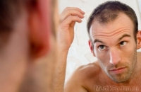 Методы проведения пересадки волос
