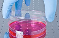Новые способности пуповинной крови: стволовые клетки против смертельного заболевания легких