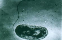 У берегов США начал размножаться опасный патоген, предупреждают специалисты