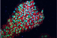 Ученые обнаружили более универсальный подход к созданию стволовых клеток