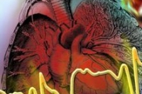 FDA одобрило препарат Edarbyclor для лечения артериальной гипертензии FDA одобрило препарат Edarbyclor для лечения артериальной гипертензии