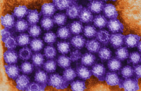 Вспышка норовирусной инфекции затронула три четверти миллиона британцев