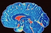 Сенсация: ученые разгадали секрет развития болезни Альцгеймера