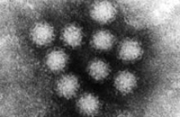 Британские специалисты опасаются массовой вспышки норовируса
