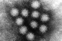 Британские специалисты опасаются массовой вспышки норовируса Британские специалисты опасаются массовой вспышки норовируса