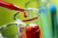 Анализ крови позволяет предсказать смерть от сердечного приступа Анализ крови позволяет предсказать смерть от сердечного приступа