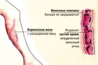 Ортопедические подушки в сети «Ладомед»