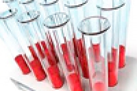 Степень тяжести холеры зависит от группы крови человека Степень тяжести холеры зависит от группы крови человека