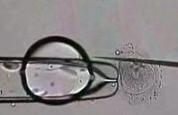 Вопрос отбора эмбрионов по половому признаку при ЭКО до сих пор не урегулирован