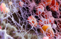 Агрегация протеинов внутри клеток — причина множества болезней