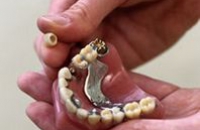 American Dental Association предупреждает: кремы для фиксации зубных протезов могут быть небезопасны для здоровья!