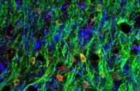 Клетки кожи превратили в клетки мозга за один этап